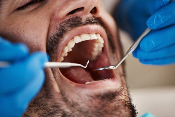 Best 24-Hour Emergency Dental Care in Mercersburg, PA